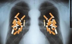 为什么有些人吸烟却并没有得癌症