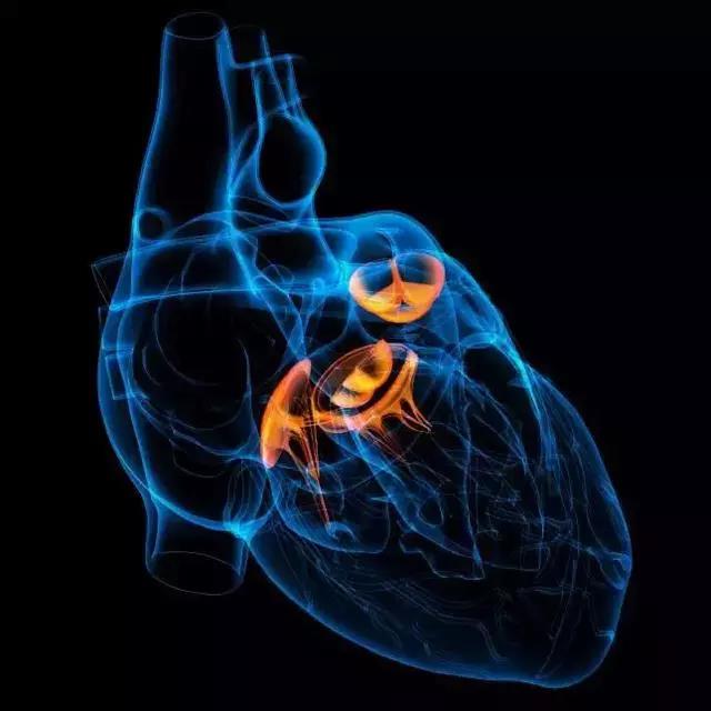 肺癌放疗副作用之心脏损伤