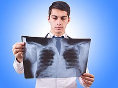 肺癌消瘦怎么办