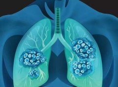 肺鳞癌吃靶向药活7-8年的概率有多少
