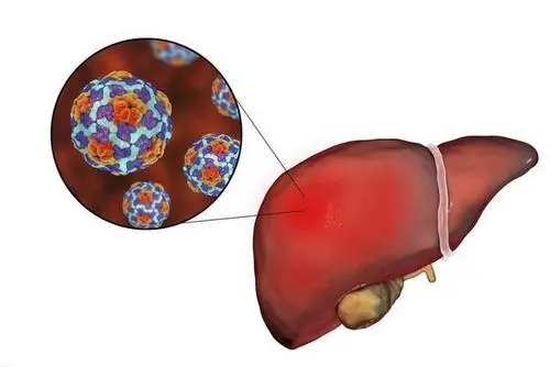 肺癌肝转移有什么症状
