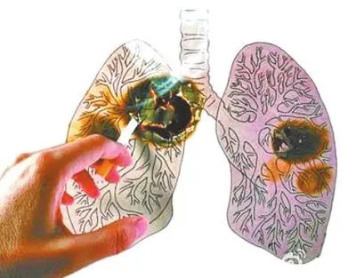 肺癌是怎么引起的