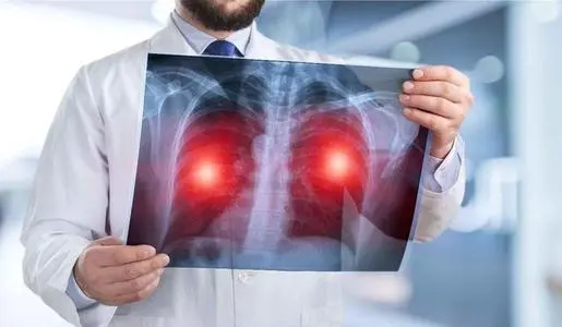 肺癌形成要多长时间