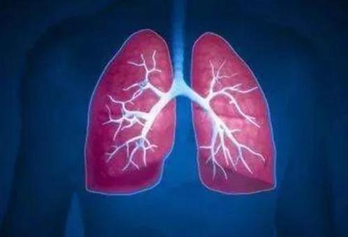 以下几类人发现肺部结节 千万不要掉以轻心