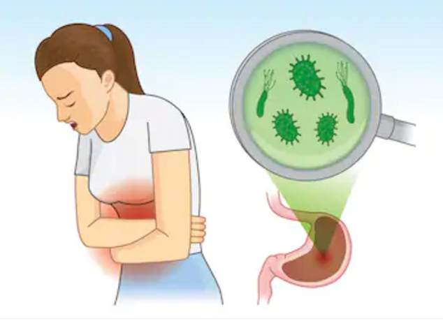 使用艾瑞卡期间发生免疫性腹泻及结肠炎怎么办