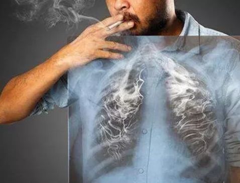 戒烟后肺部能否恢复如初