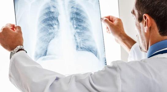 中期肺癌还有救吗
