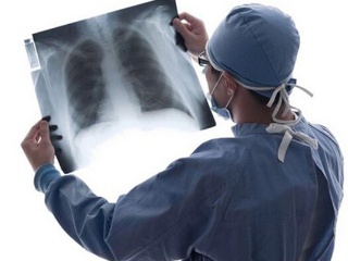 肺癌在早期有什么症状