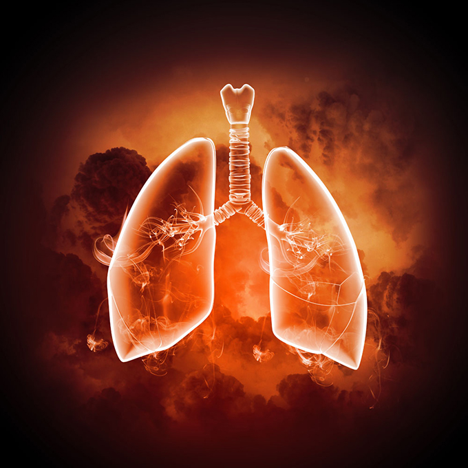 肺癌必不可少的检查: 支气管镜检查