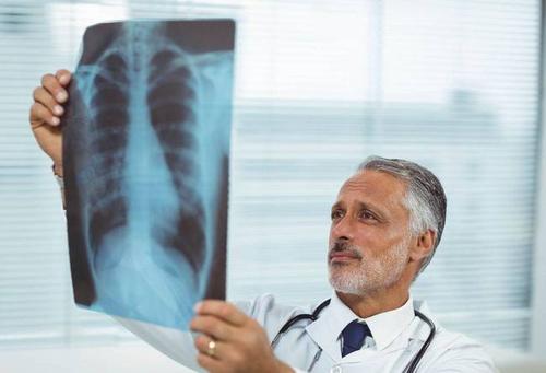 肺部肿瘤4公分是良性吗